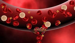 Image result for Medical Pictures of Hemophilia