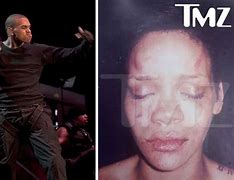 Image result for Rihanna Chris Brown Incident