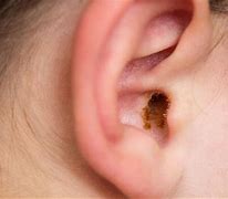 Image result for Your Ear
