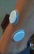 Image result for Freestyle Libre Sensor Placement