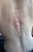 Image result for No Tatoos Just Battle Scars