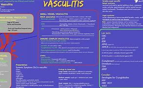 Image result for Vasculitis
