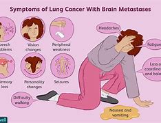 Image result for Inoperable Stage 4 Lung Cancer