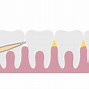 Image result for Dental Floss Interdental Brushes