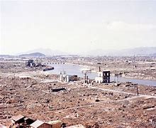 Image result for Hiroshima Bombing Casualties