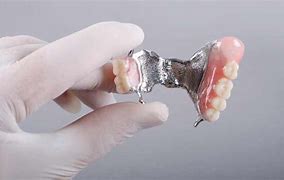 Image result for Temporary Dental Flipper