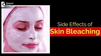 Image result for Skin Bleaching Cream Side Effects