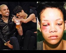 Image result for Chris Brown Hits Rihanna Story