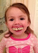 Image result for People with Big Teeth
