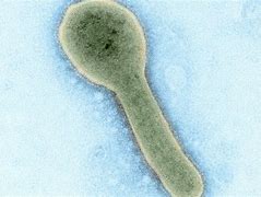 Image result for Tanzania confirms Marburg virus outbreak