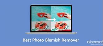 Image result for Face with Blemish