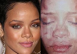 Image result for When Rihanna Got Hit by Chris Brown