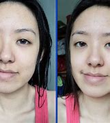 Image result for Before and After Brightening Face Mask