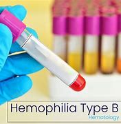 Image result for Hemophilia B