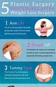 Image result for weight loss surgery
