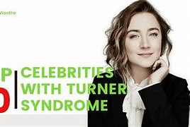 Image result for Famous People with Turner's Syndrome