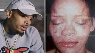 Image result for Rihanna After Chris Brown Beating