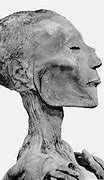 Image result for Smallpox Mummy
