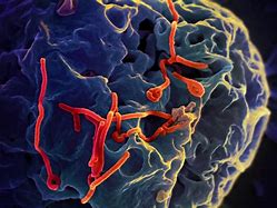 Image result for Ebola