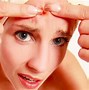 Image result for Scar Tissue Healing