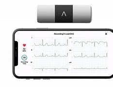 Image result for Kardiamobile 6L Wireless 6-Lead EKG By Alivecor