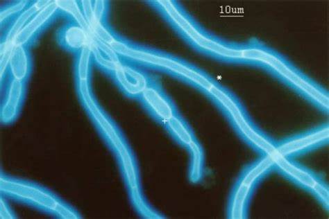 C. albicans in bianco calcofluoro al microscopio a fluorescenza