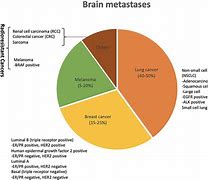 Image result for NSCLC Metastasis