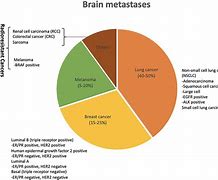 Image result for Stage 4 Brain Cancer