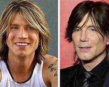 Image result for John Rzeznik Plastic Surgery Before and After