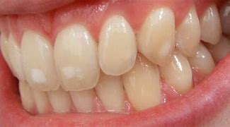 Image result for Dental Lab Direct
