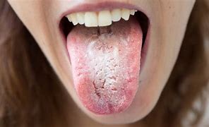 Image result for on the tongue