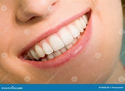 Image result for Healthy Smile