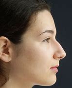 Image result for Croatian Nose