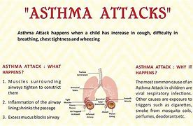Image result for Asthma Flare-Up