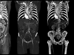 Image result for Human Anatomy CT