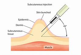 Image result for Injection Sites