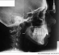 Image result for Cephalometric X-ray