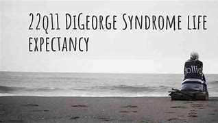 Image result for DiGeorge Syndrome Life Expectancy