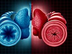 Image result for COPD Asthma