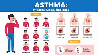 Image result for Prevent Asthma