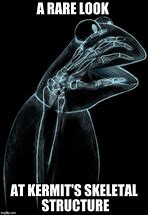 Image result for X-ray Memes