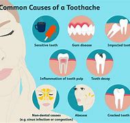 Image result for Tooth Hurts
