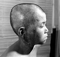 Image result for atomic bomb survivors