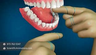 Image result for Flossing Teeth Clip Art