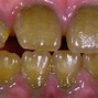 Image result for Les Dents