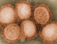 Image result for H2N2 Virus