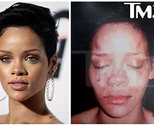 Image result for Chris Brown Punching Rihanna