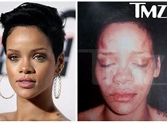 Image result for Rihanna After Chris Brown Attack