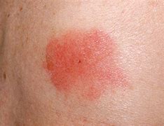 Image result for Animal Bee Stings