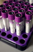 Image result for Bd Vacutainer Urine Collection Tubes